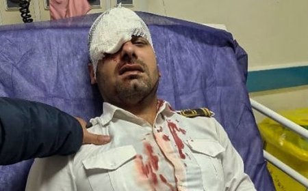نابینا شدن چشم پرسنل بیمارستان مسجدسلیمان در پی حمله همراه بیمار