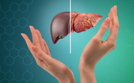 زندگی ماشینی از متهم های درجه اول افزایش کبد چرب!