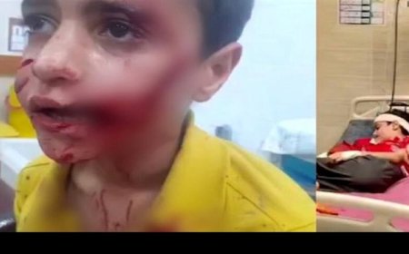 جان‌باختن کودک ۱۰ ساله در مسجدسلیمان بر اثر حمله سگ‌های ولگرد