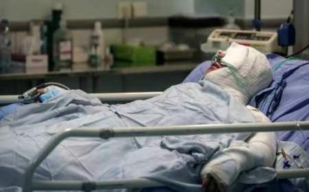 برای اولین بار در ایران: درمان سوختگی با تکنیک جراحی و پرتودهی در شیراز