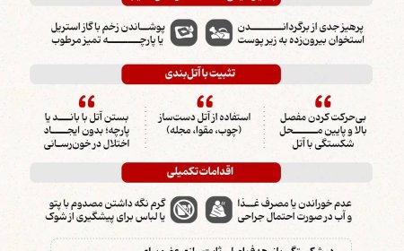 چند قانون طلایی در شکستگی‌باز