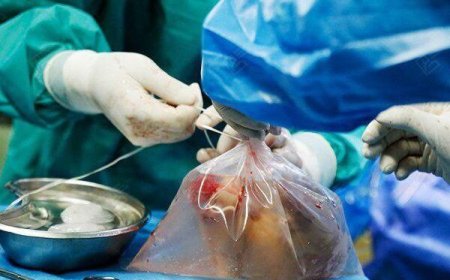 اولین اهدای عضو سال ۱۴۰۵ در هرمزگان به سه بیمار، زندگی تازه بخشید