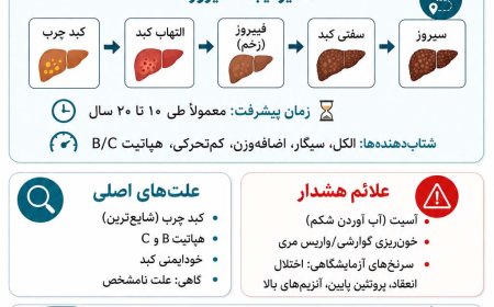 سیروز کبدی، از علائم تا عوارض